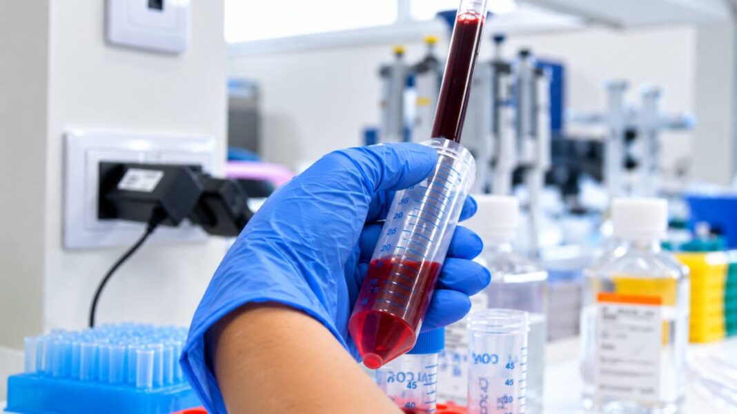 Madrid participa en proyecto europeo para mejorar prevención del cáncer en salud mental - imagen 1